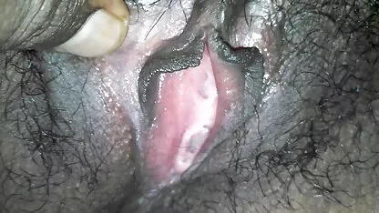 La porno hopital beauté submerge tout